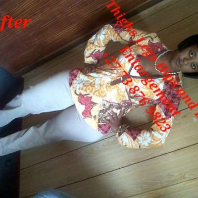 Botcho Cream +27738769823 Butt Enhancement Cream Pills For Bums +27738769823 Bum Enlargement Pills Legs Enlargement +27738769823 Hip Bum Butt Enlargement