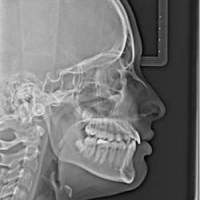 Nowoczesna diagnostyka w DentalArt Słubice